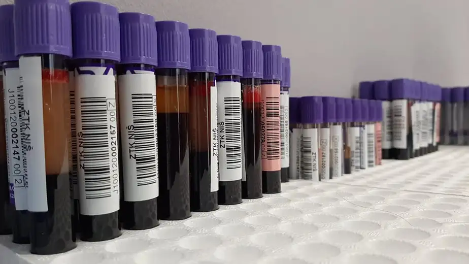 Održana još jedna akcija dobrovoljnog davalaštva krvi