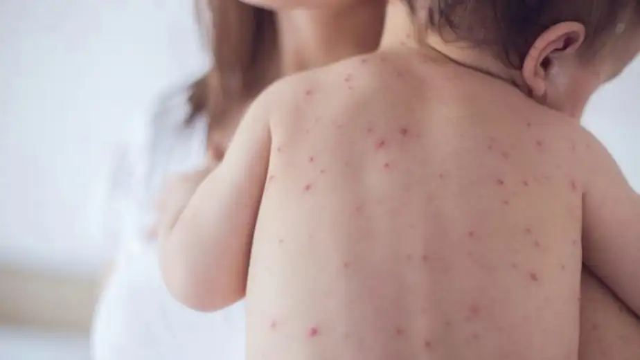 Zabrinjavajuće: Veliki broj roditelja u Boru i Zaječaru i dalje decu ne dovodi na vakcinaciju!