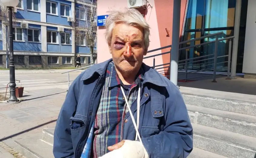 Napali ga psi: Slaviša Bacić iz Vražogrnca zadobio povrede nakon pada sa bicikle