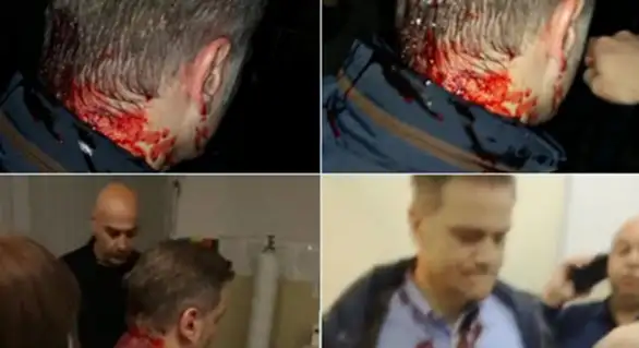 Borku Stefanoviću razbijena glava tokom tribine u Kruševcu