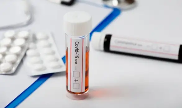 PCR test najskuplji u Srbiji