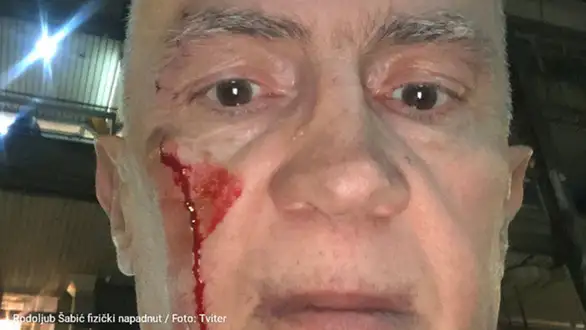 Fizički napad na Rodoljuba Šabića