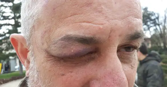 Pretučen Strahinja Ćirić aktivista 1 od 5 miliona u Negotinu (FOTO+VIDEO)