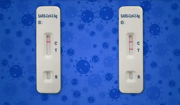 Antigenski test u Srbiji pet puta skuplji nego u Nemačkoj